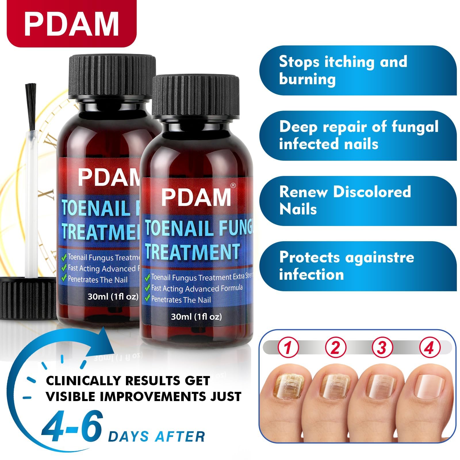 PDAM penetrates skin around nail to target fungus.