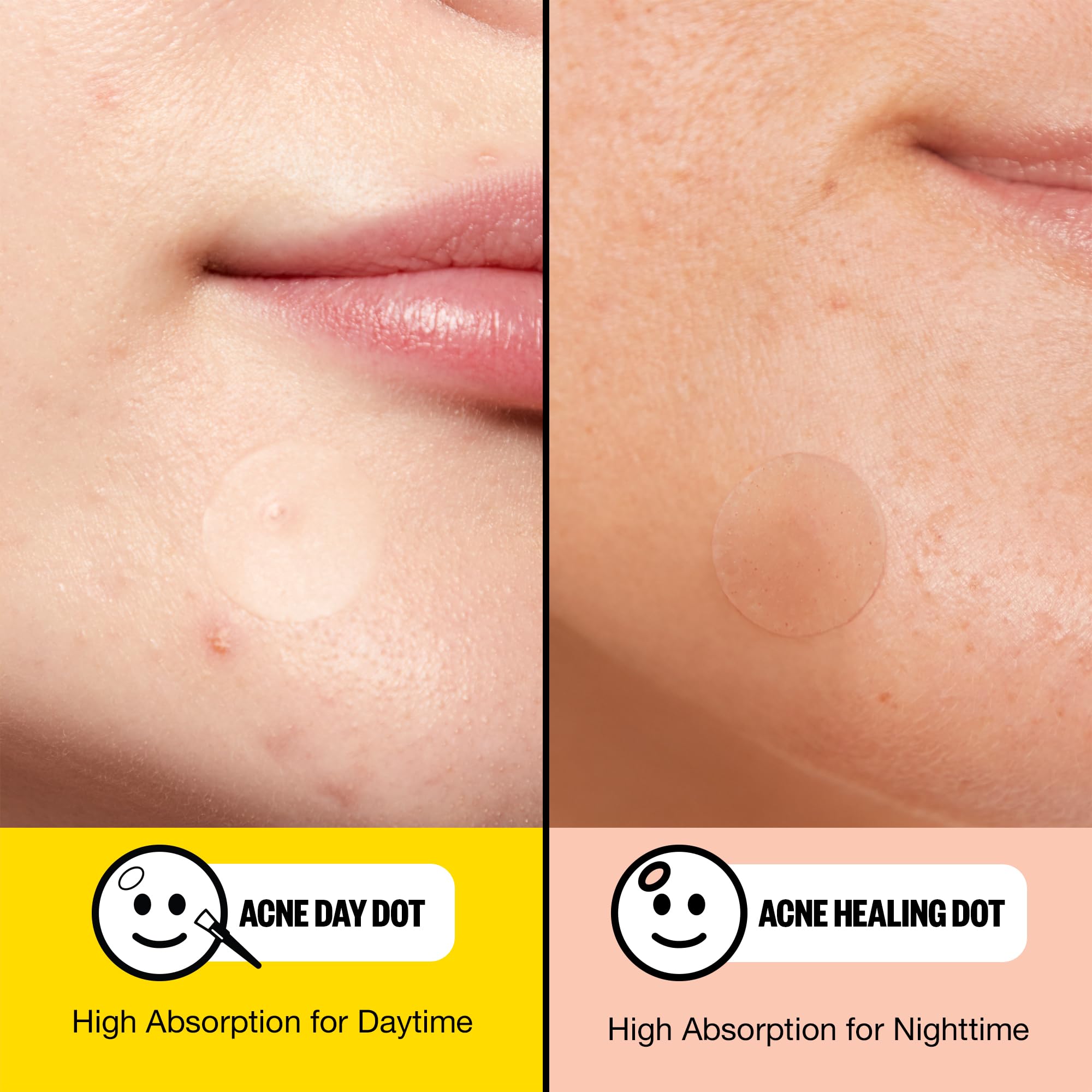Peace Out 2% Salicylic Acid graphic indicating pore cleansing and blemish targeting