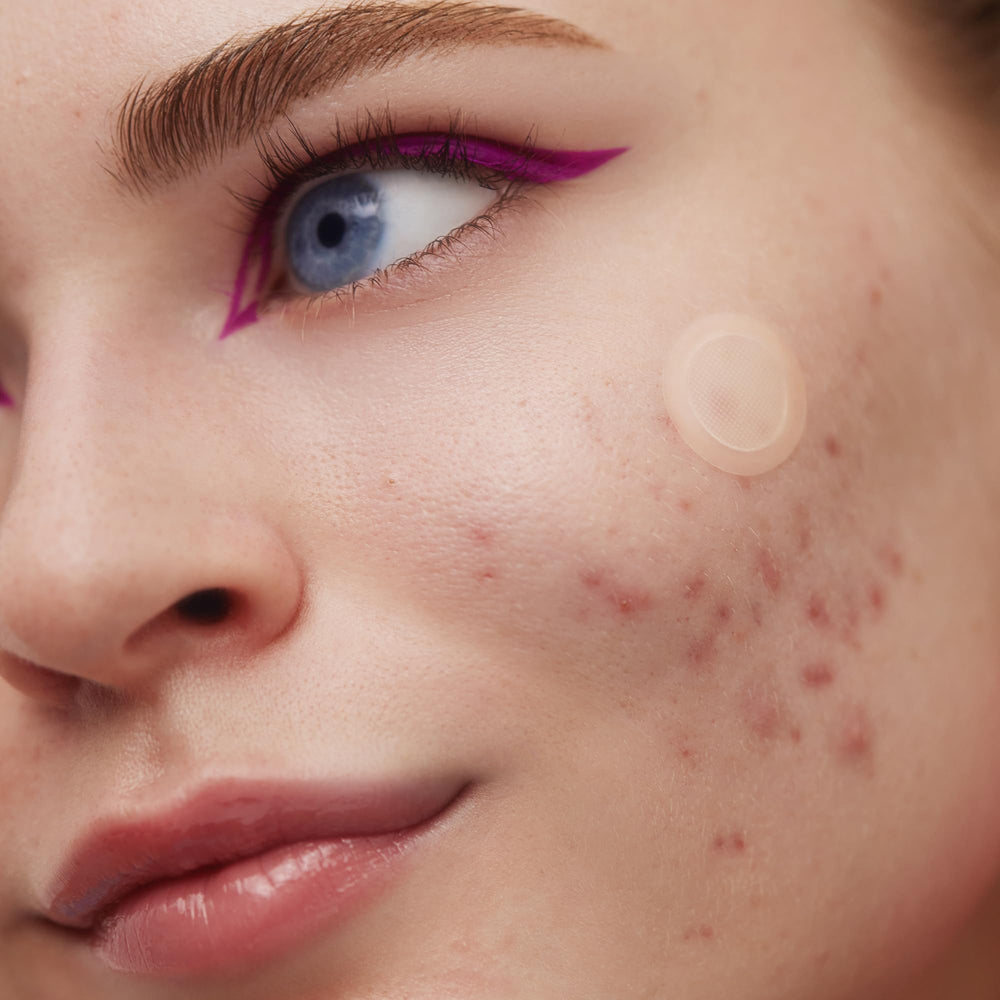 PEACE OUT Early Stage Acne Dots salicylic-acid ingredient illustration