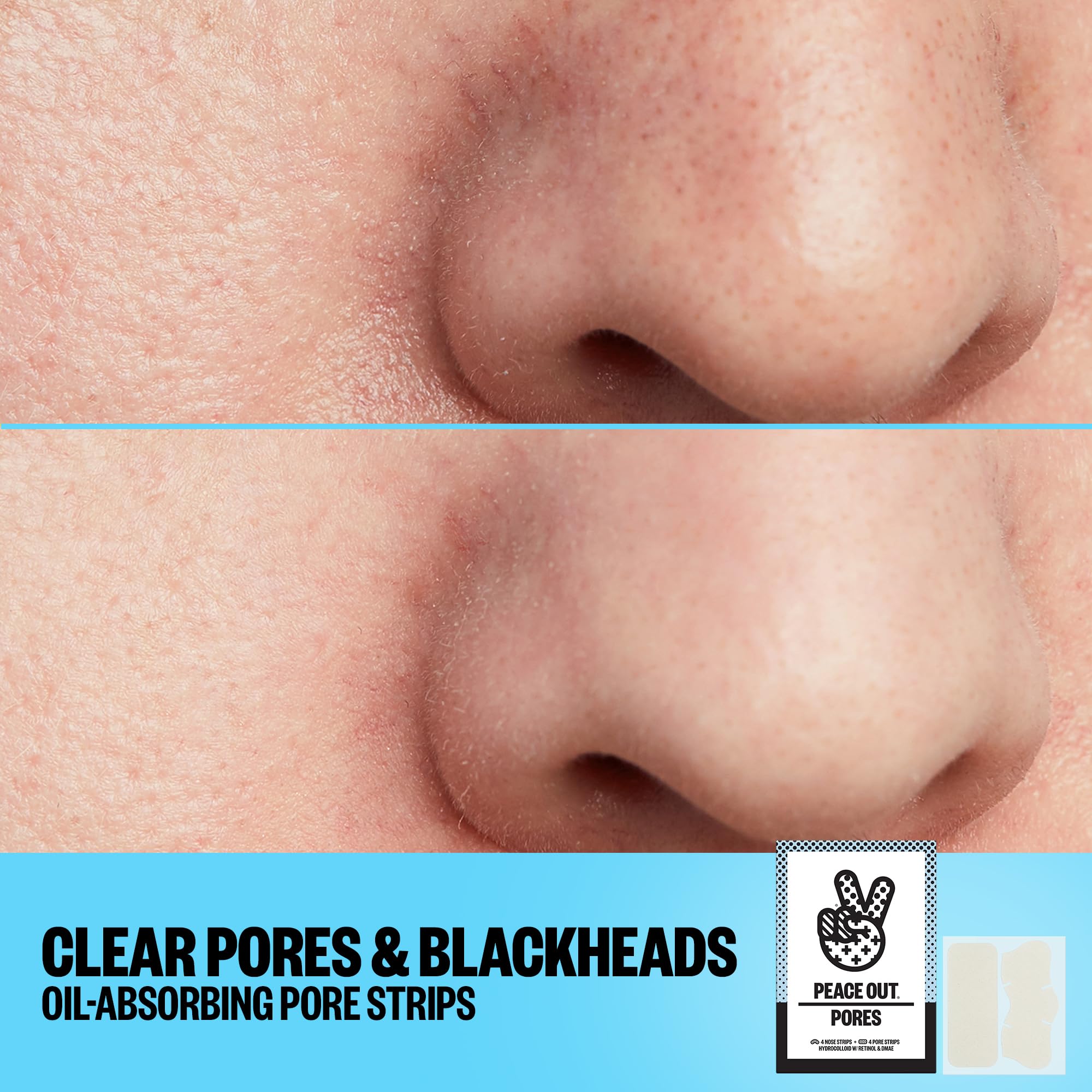 Peace Out hydrocolloid strip delivers targeted absorption for clogged pores.