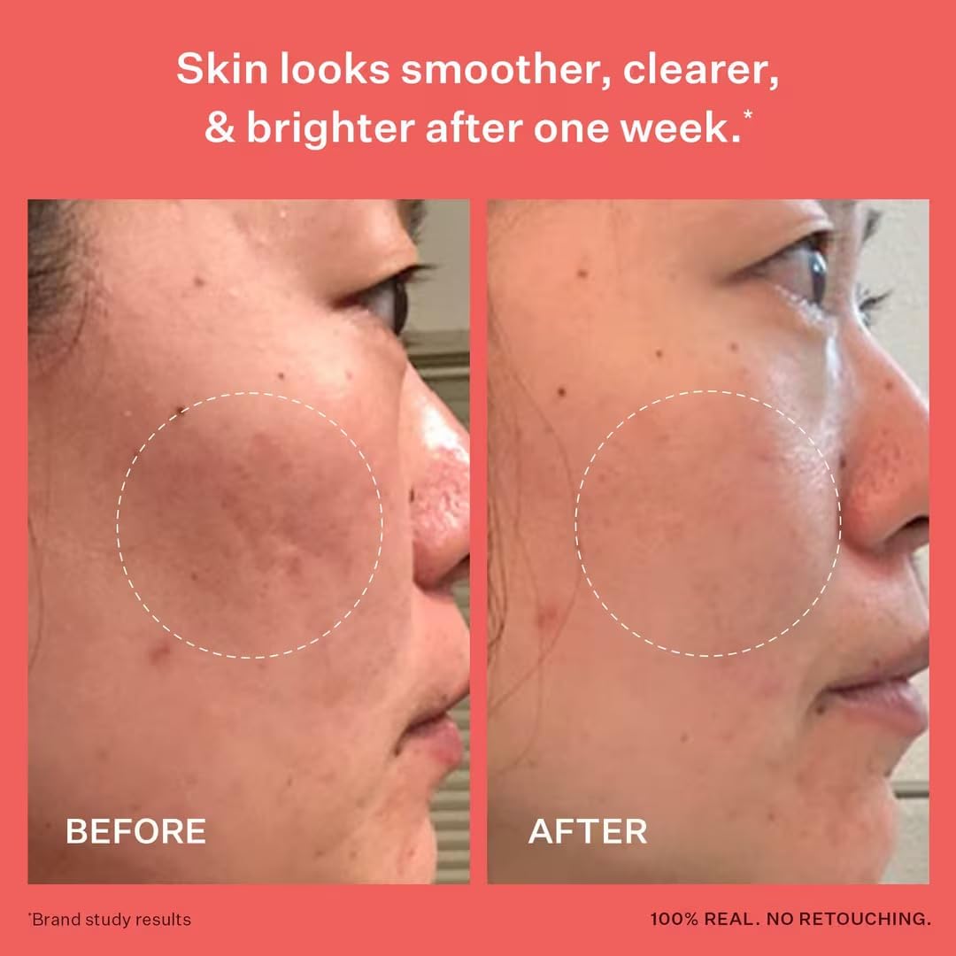 Peach & Lily ingredient-niacinamide emphasizes brightening and calming potential for irritated areas.