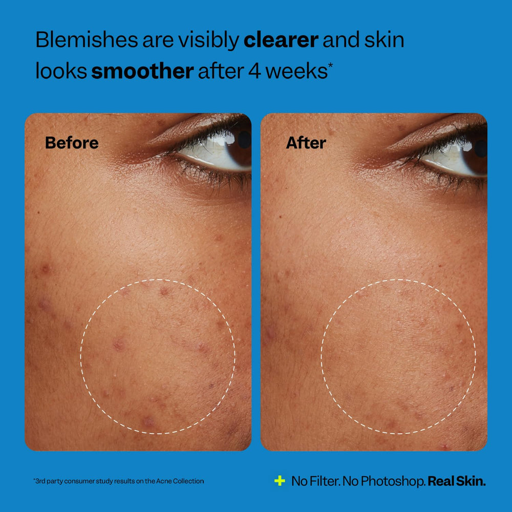 Niacinamide and acerola in Peach Slices oil-free moisturizer for balanced skin