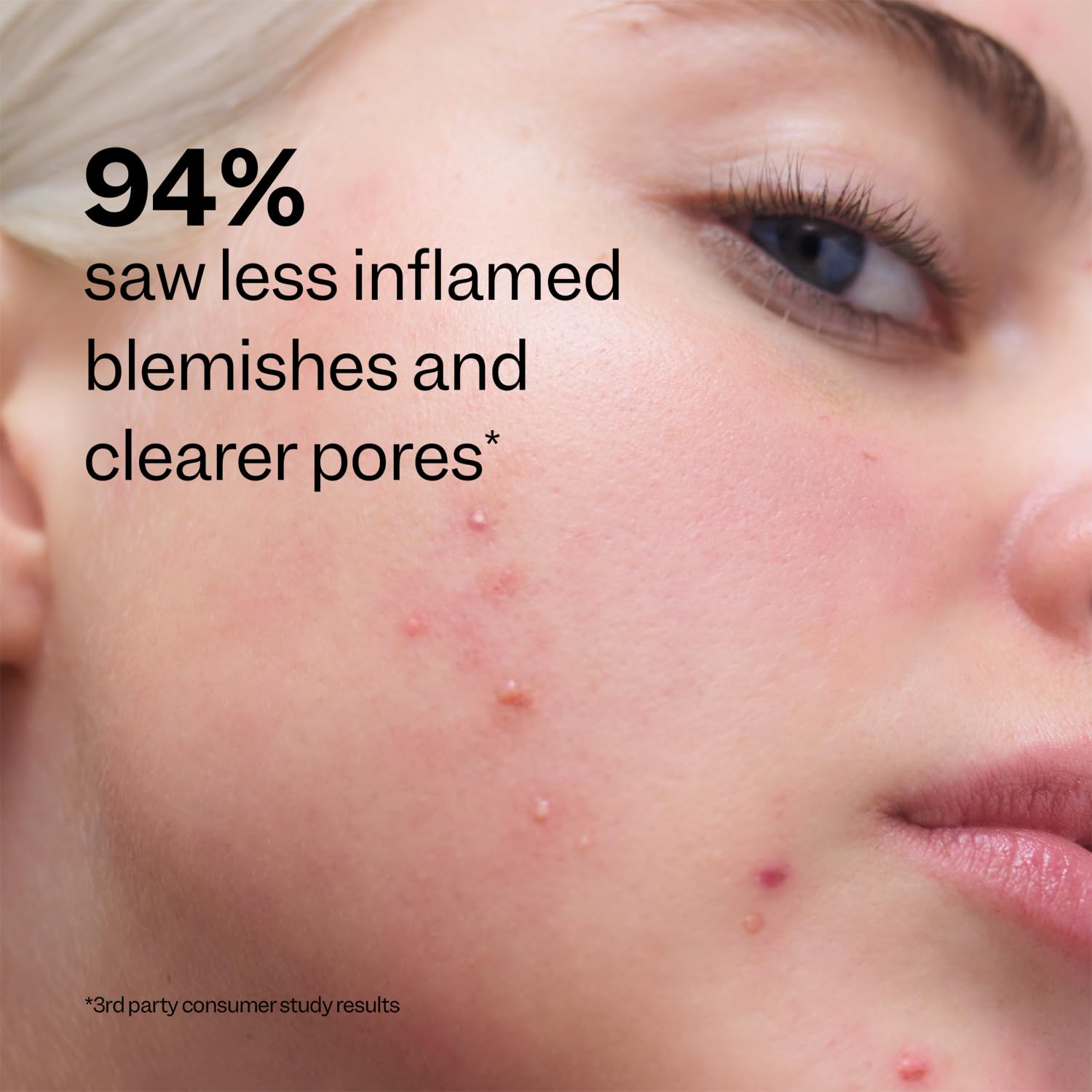 Peach Slices skincare steps visual suggests a holistic routine