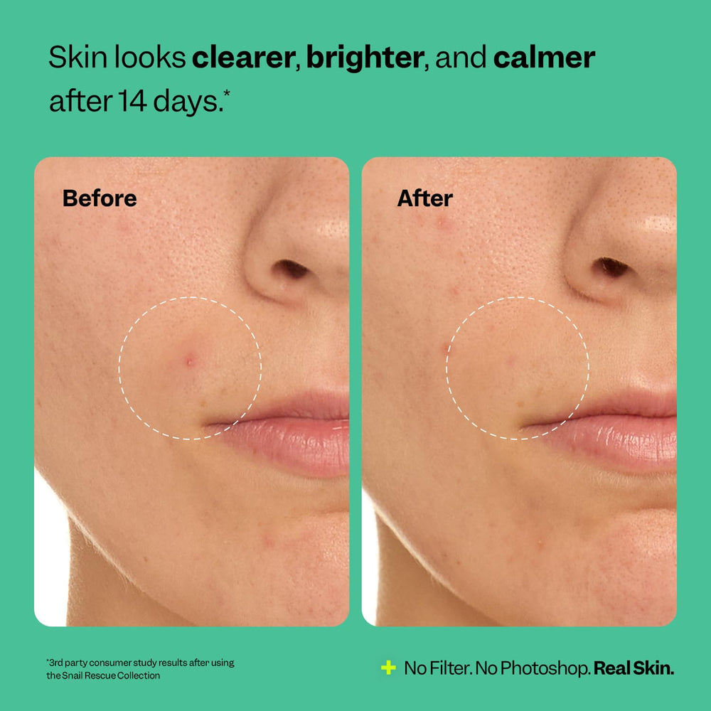 Peach Slices Snail Rescue Purifying Cleanser packaging display; vegan branding