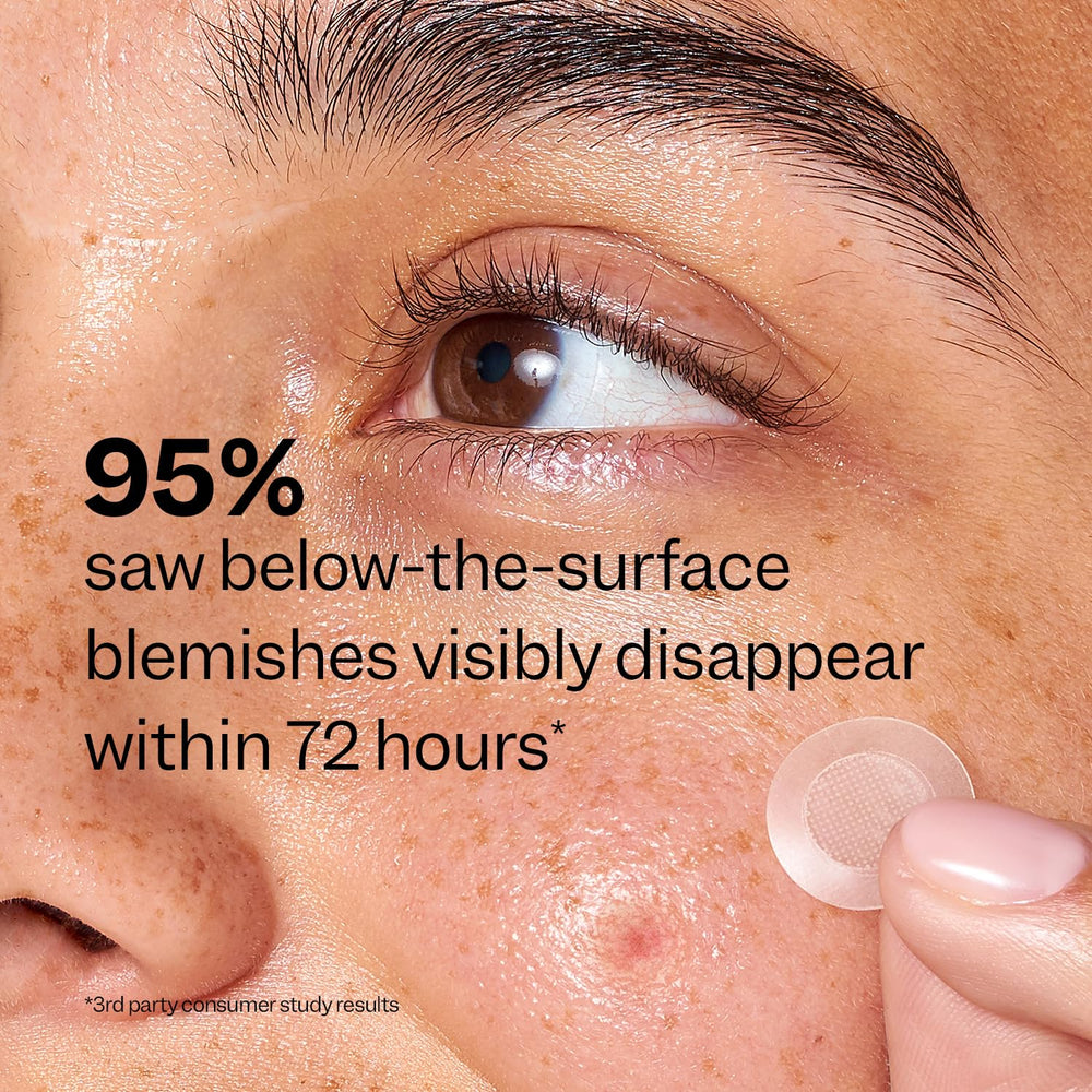 Step-by-step view of cleansing, applying patch, and removal.