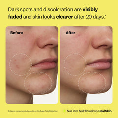 Peach Slices tranexamic acid detail highlights discoloration targeting