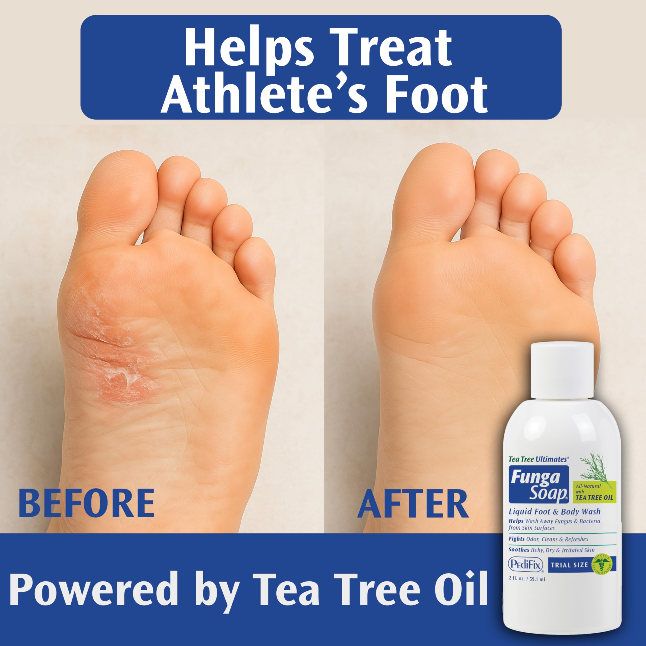 Pedifix FungaSoap 2oz pour demonstrates full-strength formula in a portable bottle.
