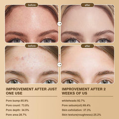 Peel Shot Glow duo pack front view showing day and night exfoliation routine