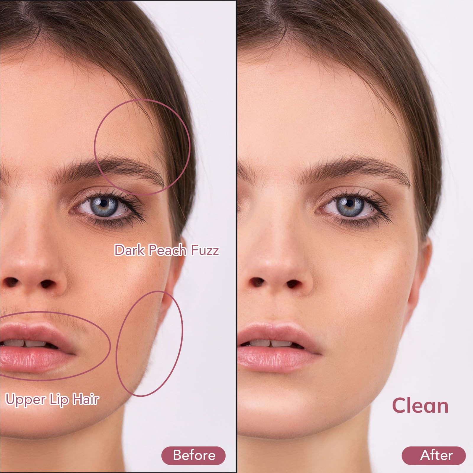 PELCAS dermaplaning tool showing three speed levels for customization