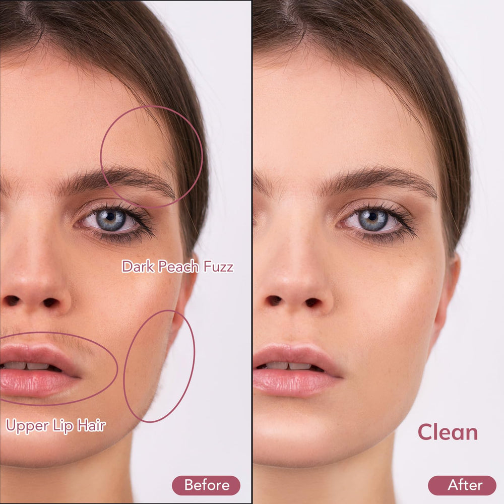 PELCAS dermaplaning tool showing three speed levels for customization
