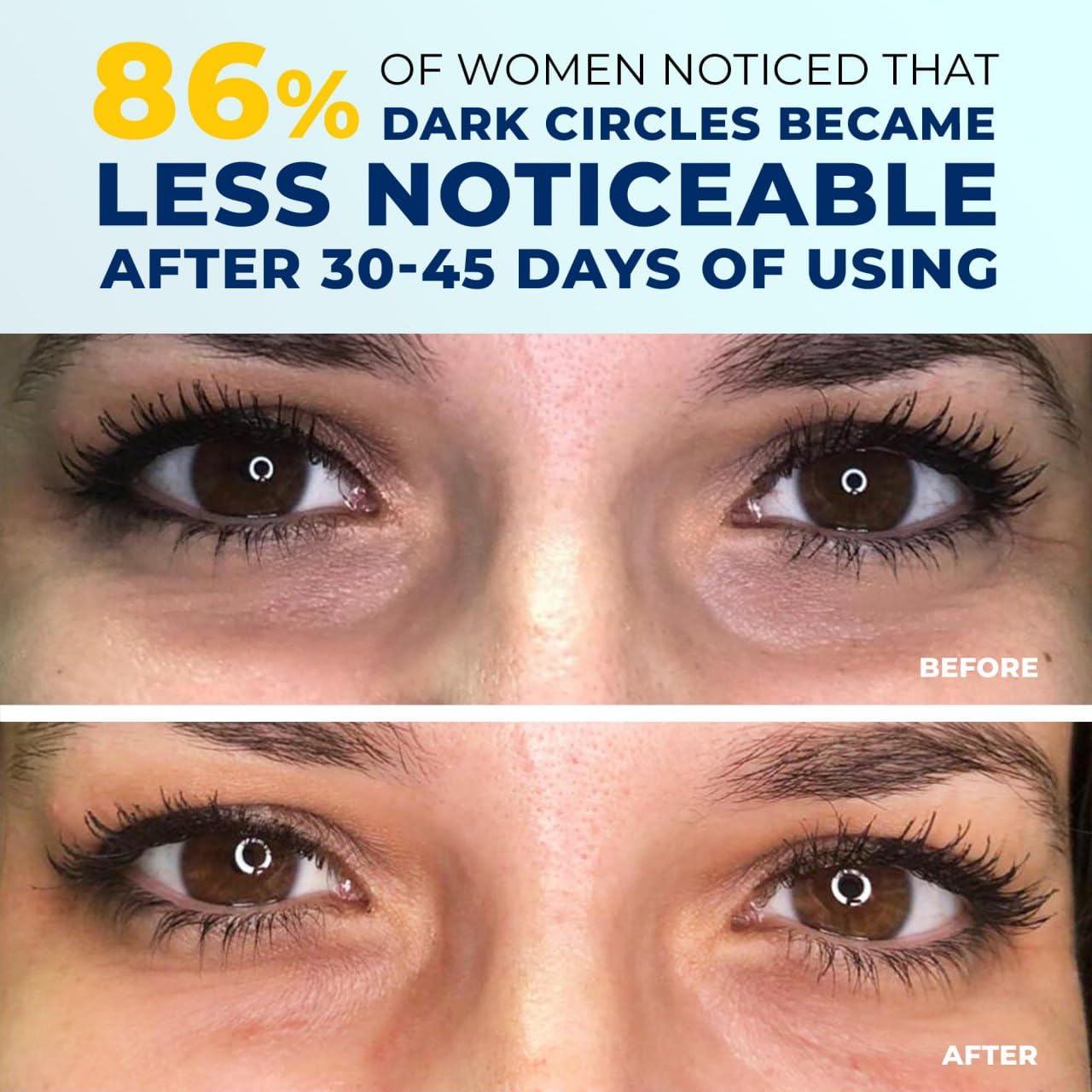 Penebella formula delivers hyaluronic acid and collagen for hydrated under-eyes.