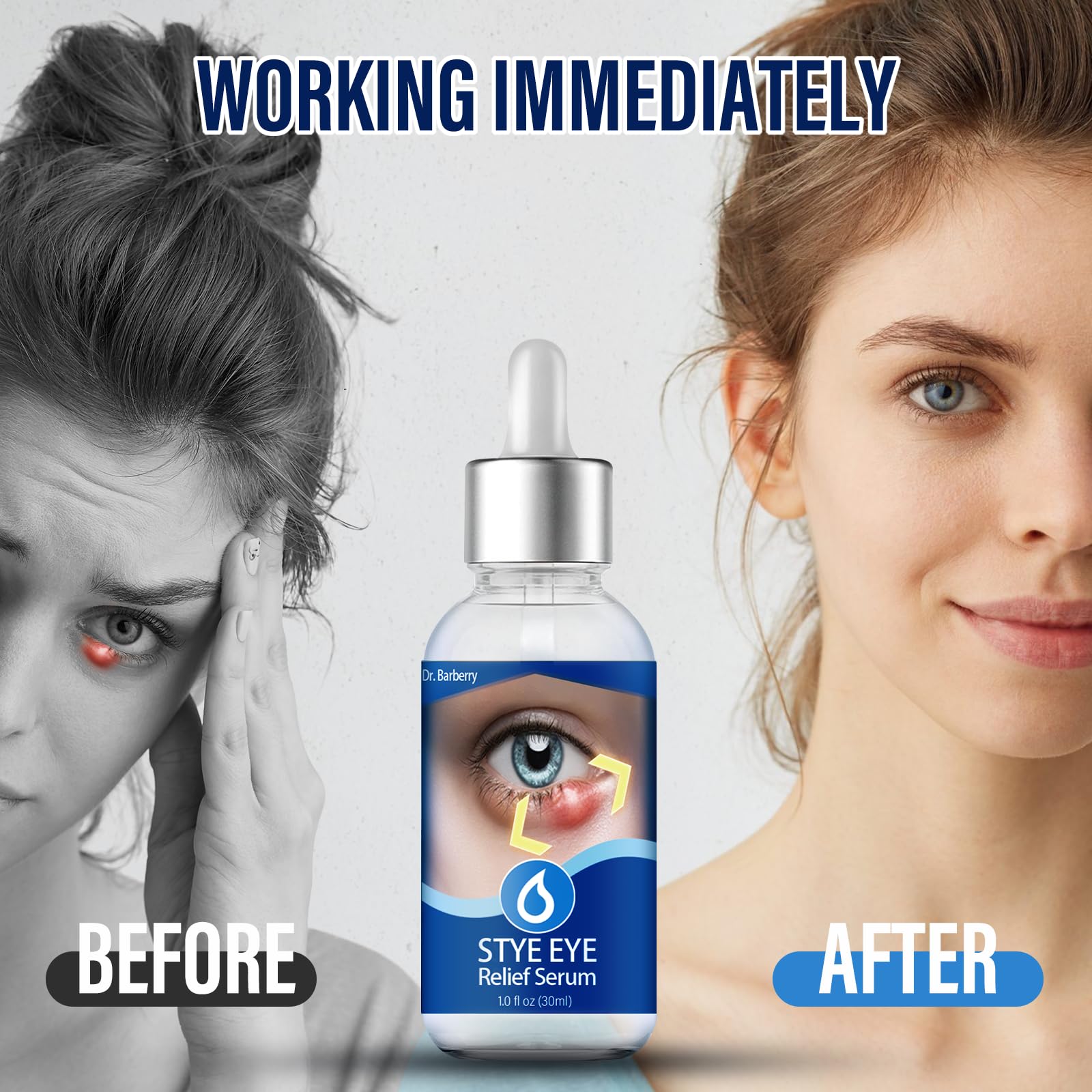 Penntr Stye Eye Drops packaging box indicates portable eyelid care solution.