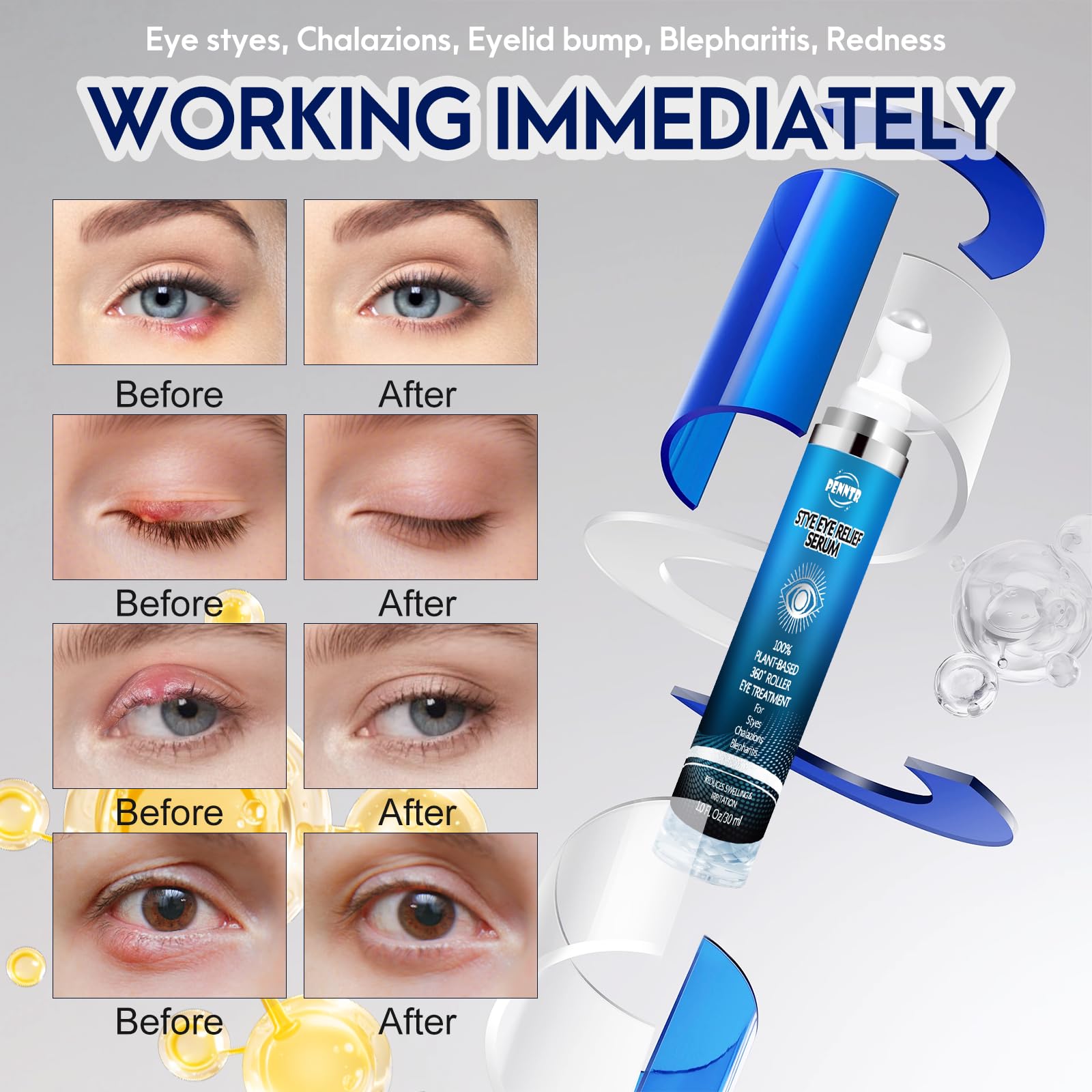 Compact PENNTR bottle shown as travel-friendly solution for eyelid care