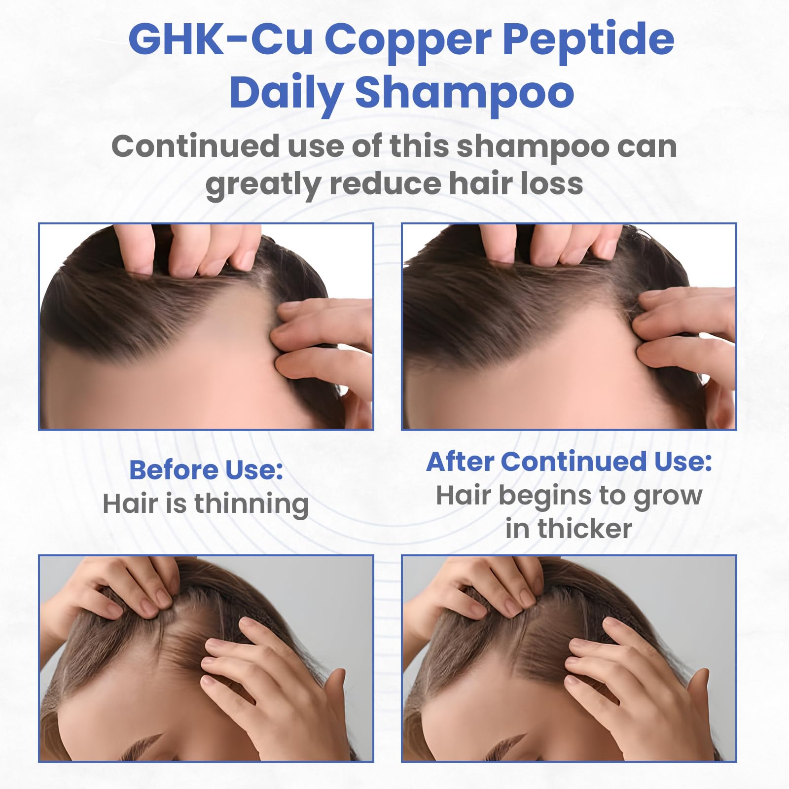 PeptideLabz Copper Peptide Shampoo lather action demonstrating cleansing and scalp nourishment