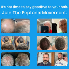 Close-up of Peptonix serum on scalp with hair strands
