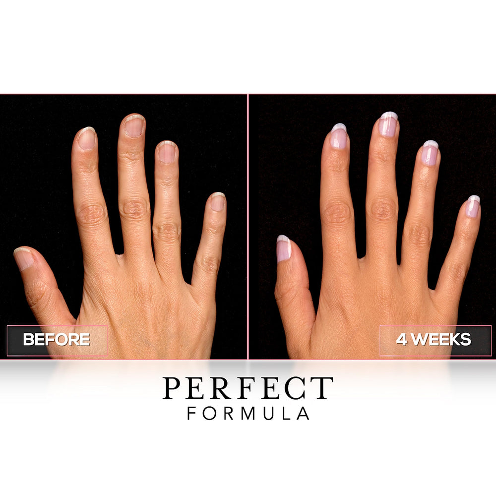 Keratin-rich formula visible on nails suggests stronger, smoother growth with Perfect Formula.