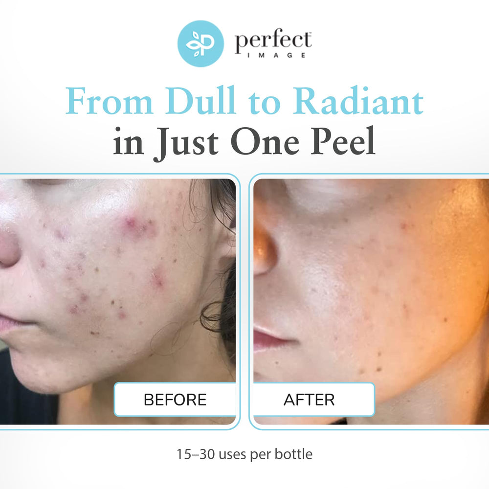 Perfect Image gel peel application swatch demonstrates smooth, even layer.