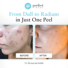 Perfect Image gel peel application swatch demonstrates smooth, even layer.