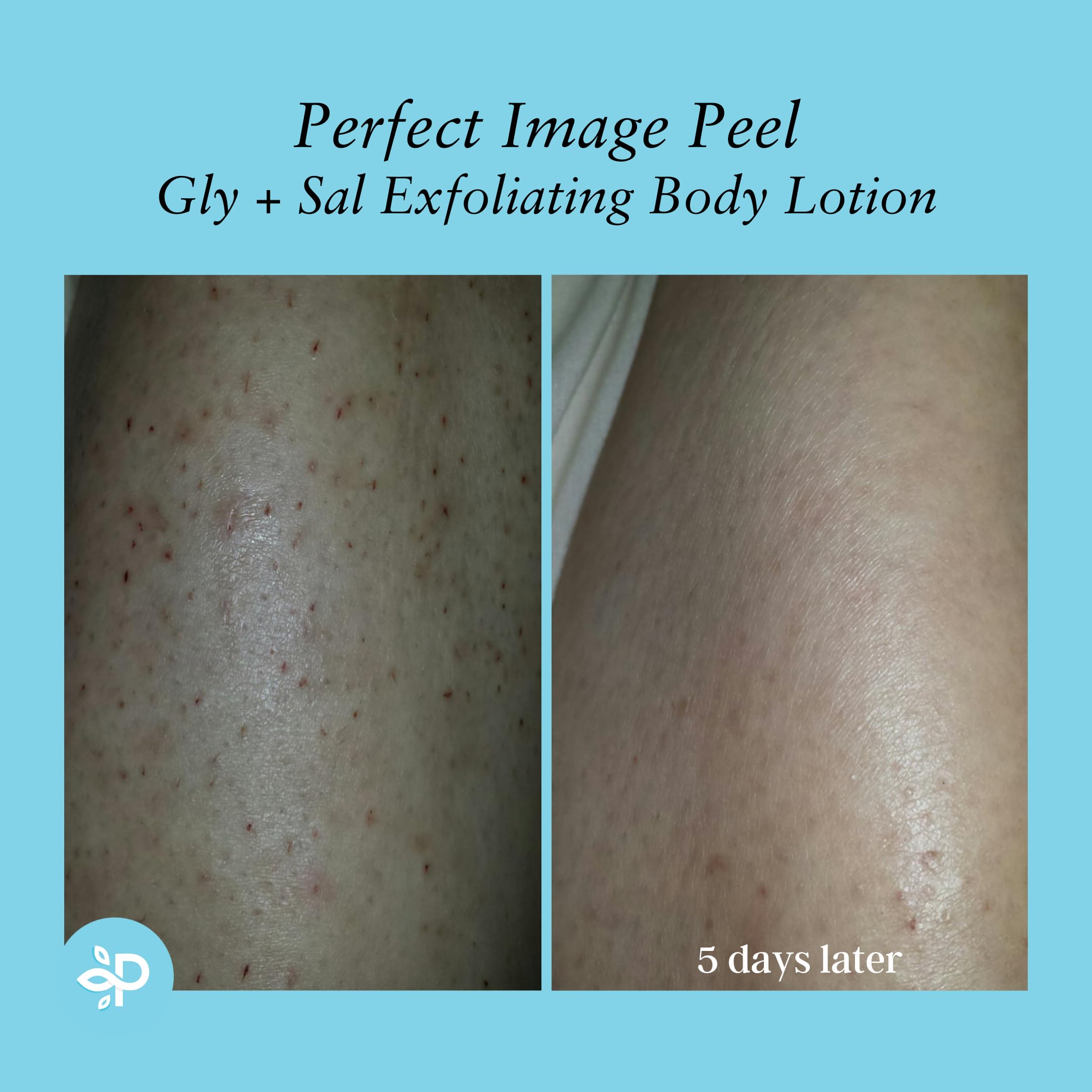 Spa-like result imagery for at-home care with Perfect Image lotion