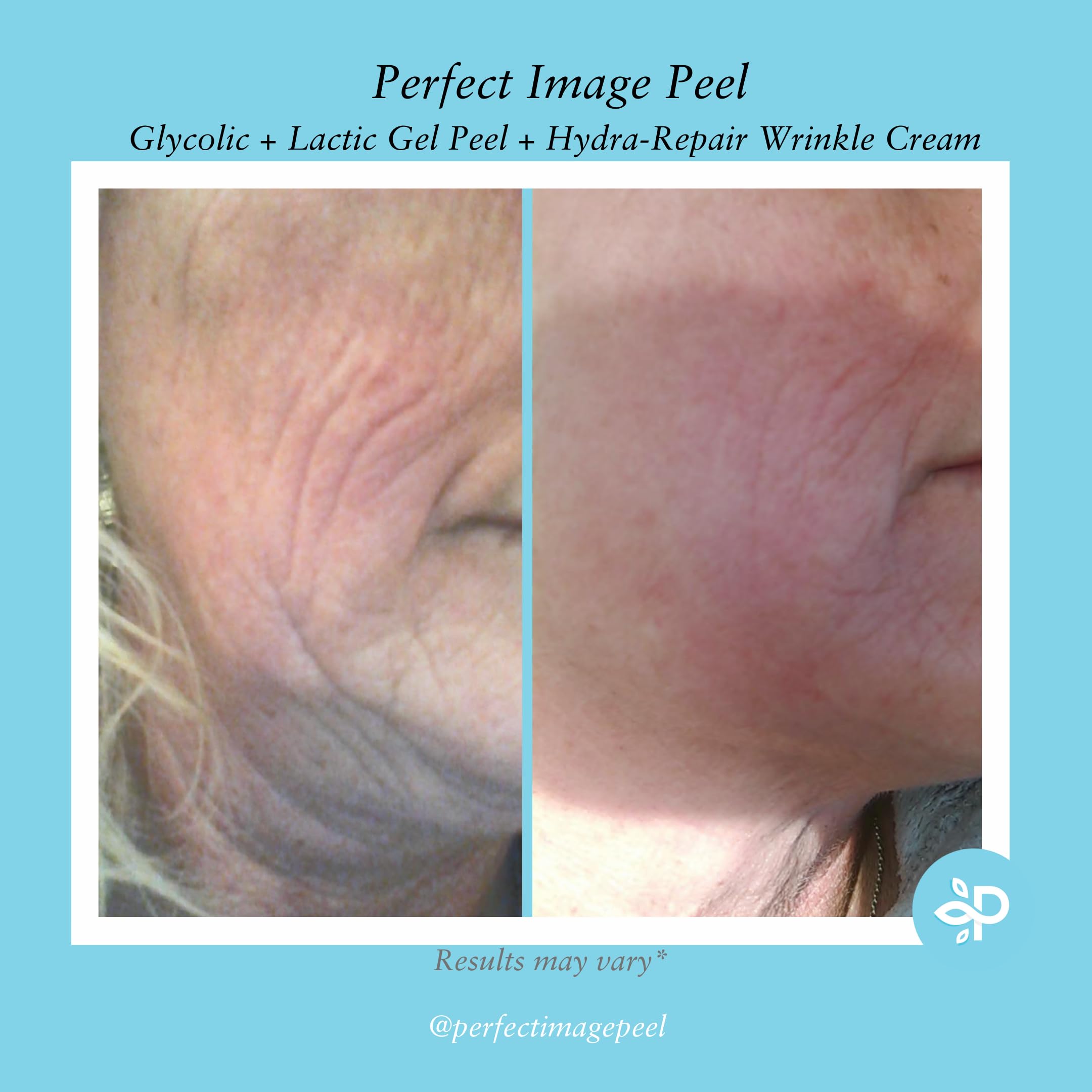 Green tea extract detail in Perfect Image Glycolic Gel Peel ingredients.
