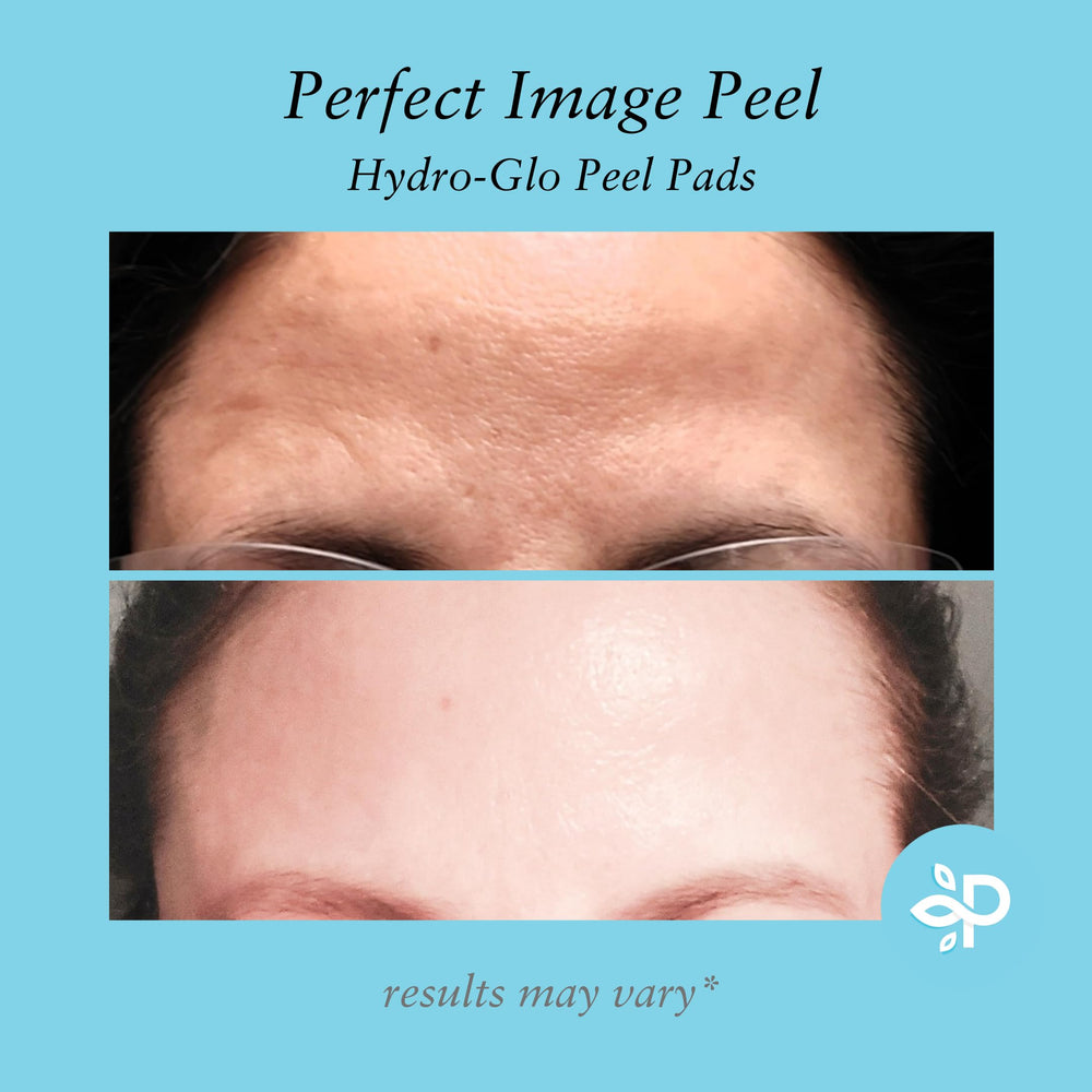 Perfect Image Hydro-Glo Peel Pad after-use skin looks refreshed and hydrated