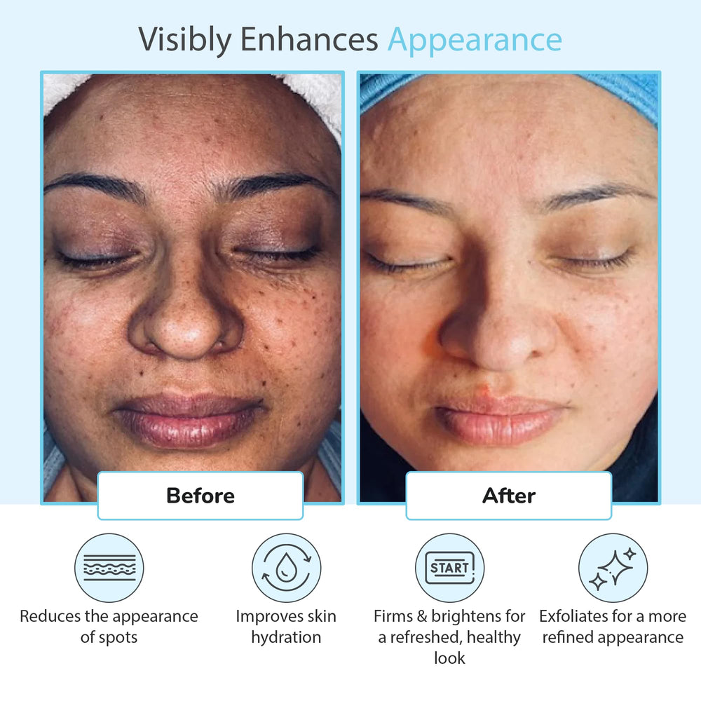 Perfect Image retinol-green-tea label shows enhanced formulation