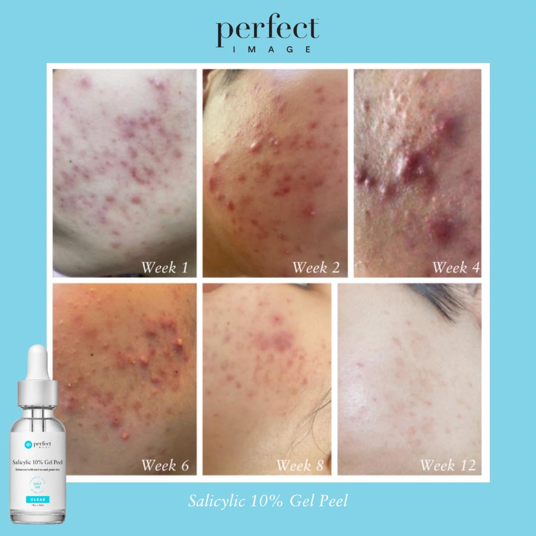 Perfect Image gel peel imagery with cucumber and chamomile soothing extracts.