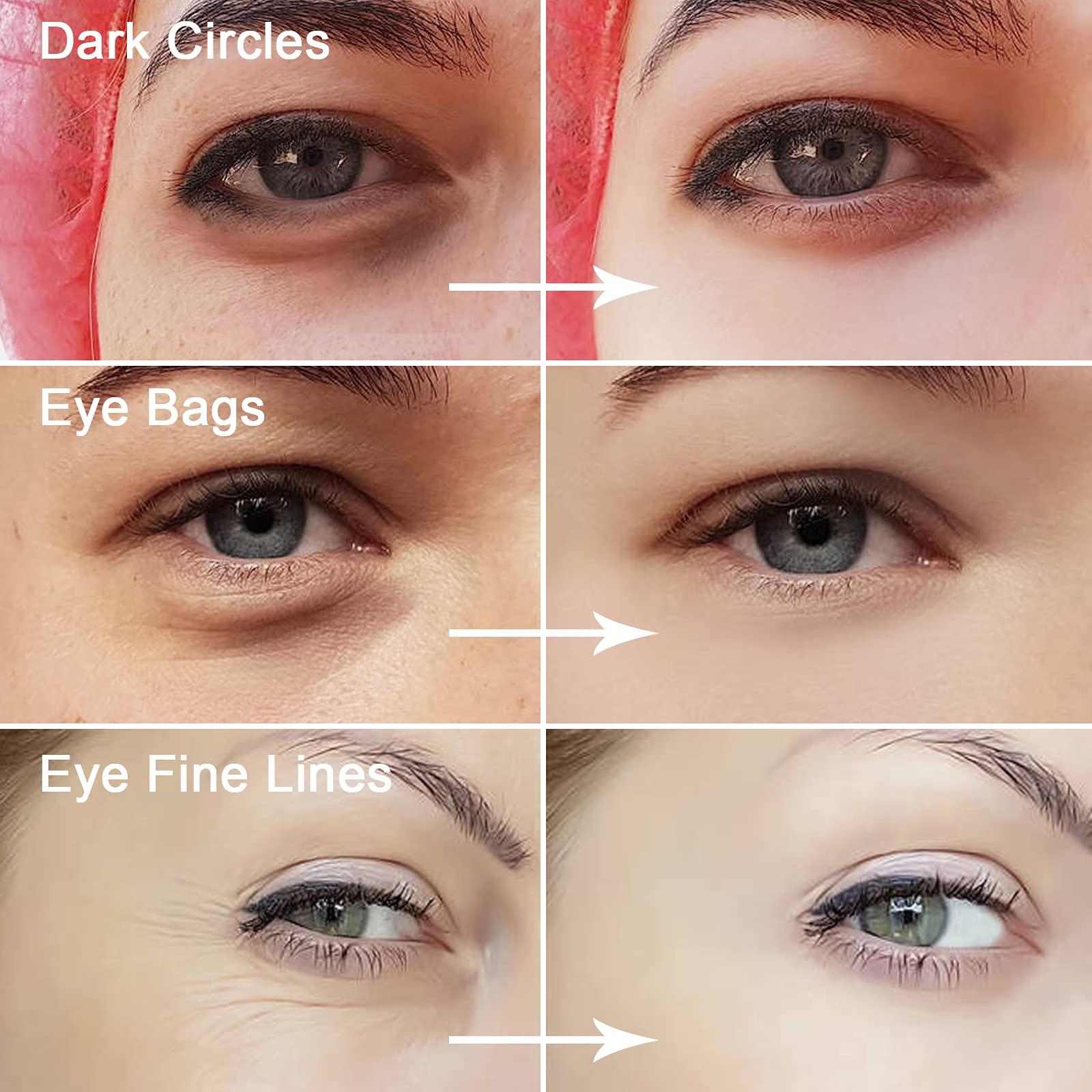 Permotary moisturizing eye patches lock in hydration for lasting comfort.