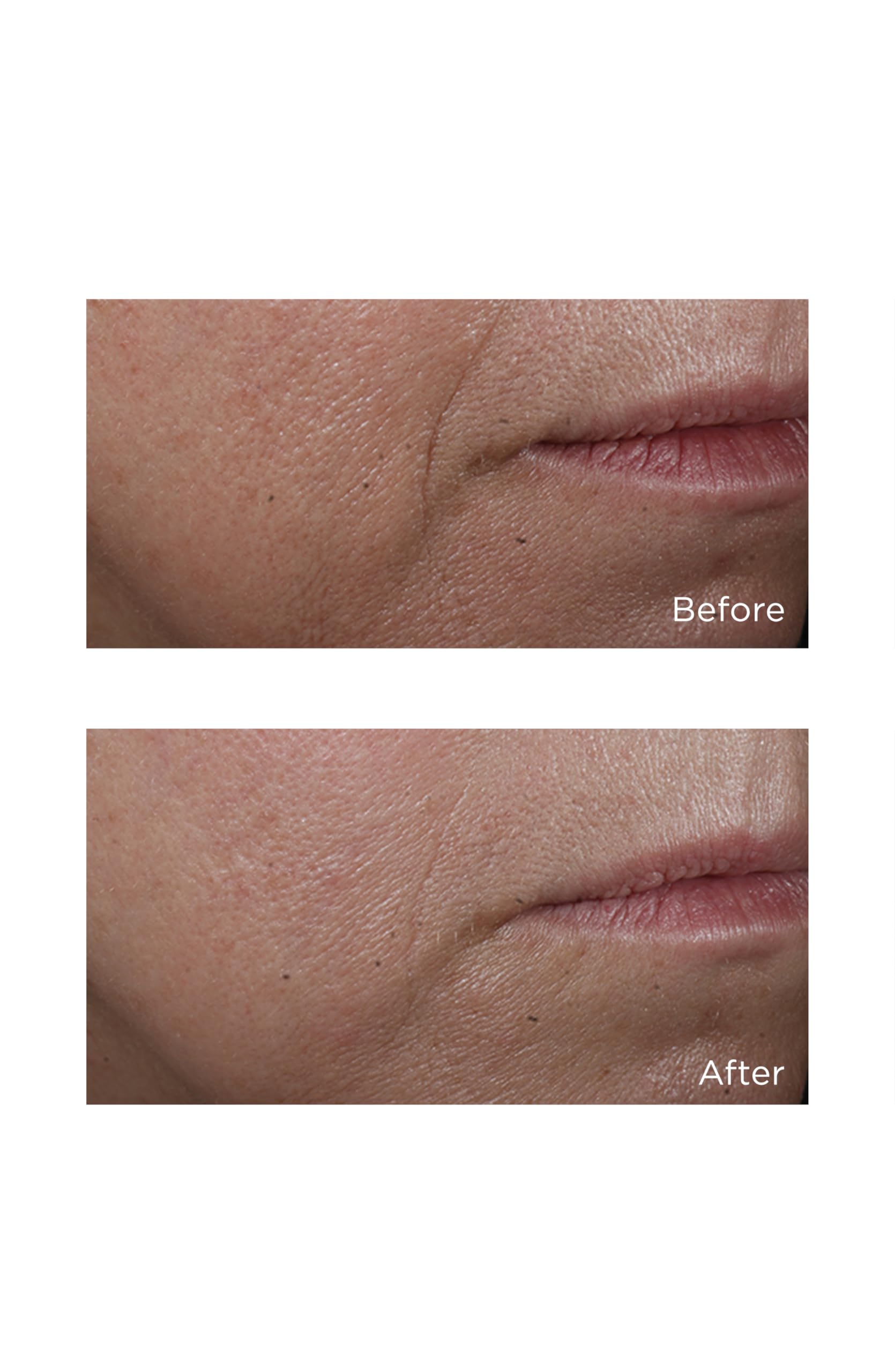 Perricone MD Cold Plasma Plus+ vitamin C ester graphic highlights brightening potential.
