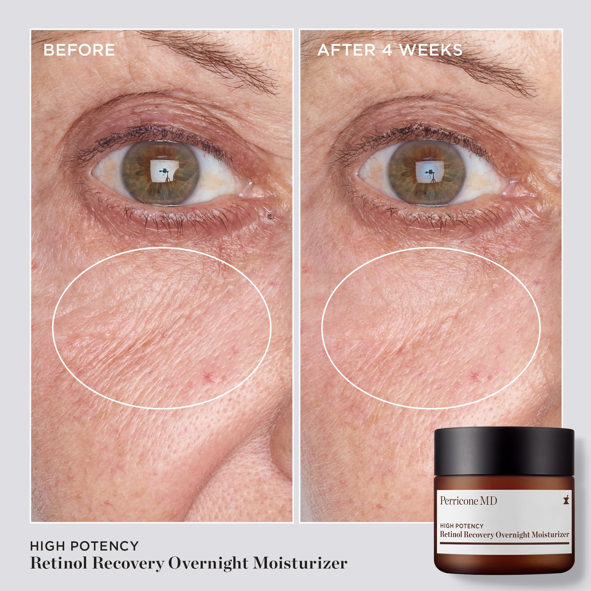 Perricone MD vegetable triglyceride complex close-up emphasizes deep hydration and barrier support