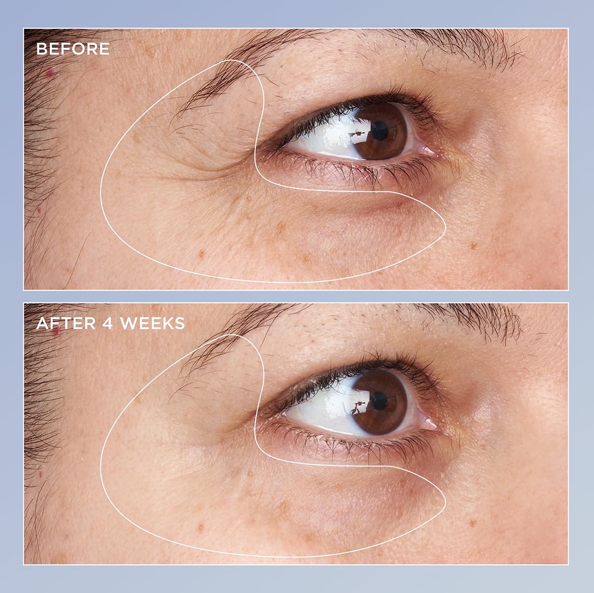 Perricone MD eye serum beta-carotene texture close-up suggesting anti-photoaging support.