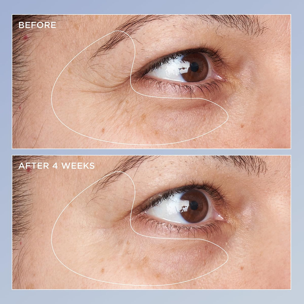 Perricone MD eye serum beta-carotene texture close-up suggesting anti-photoaging support.
