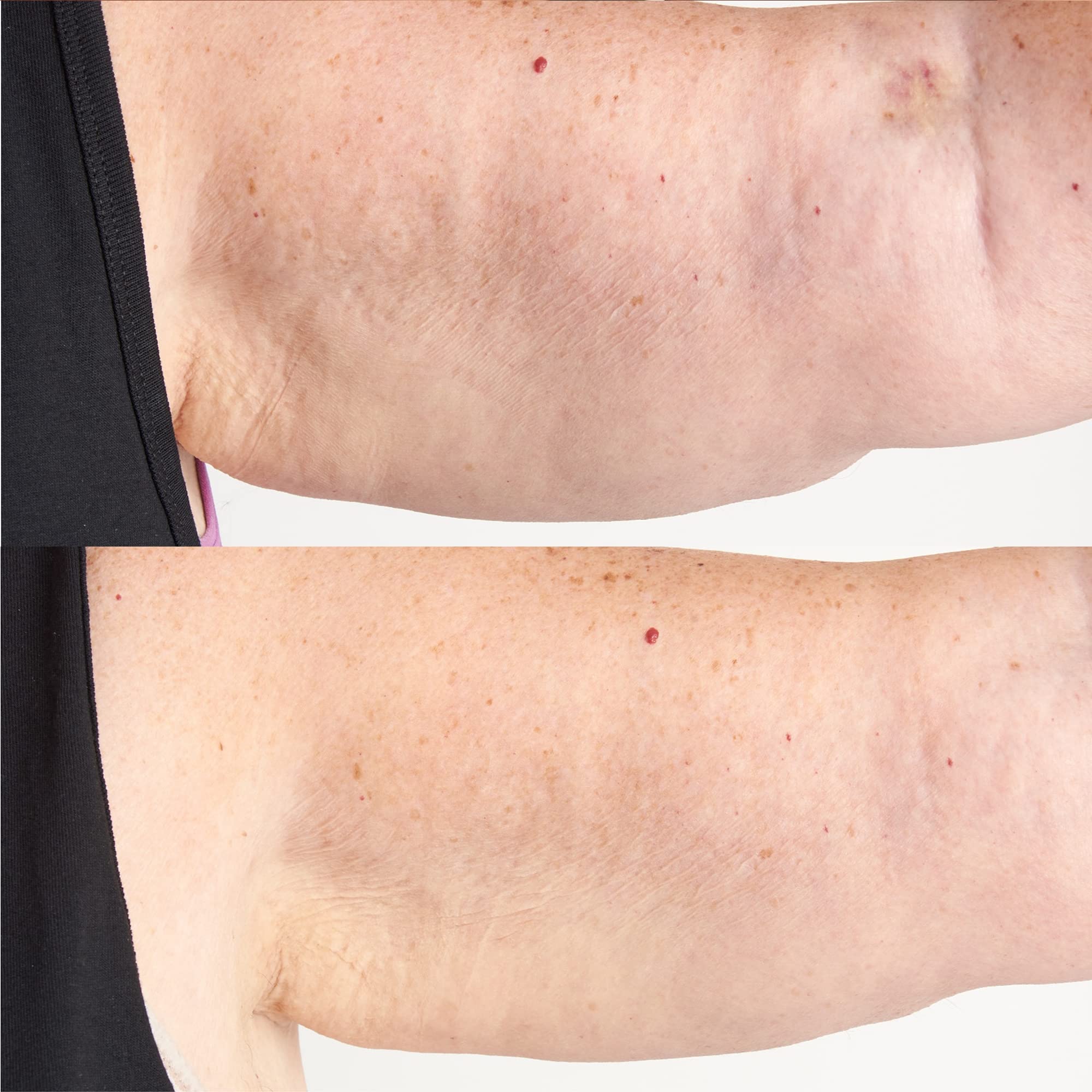 Perricone MD Hyaluronic Intensive Body Therapy applied by hands for smooth absorption.