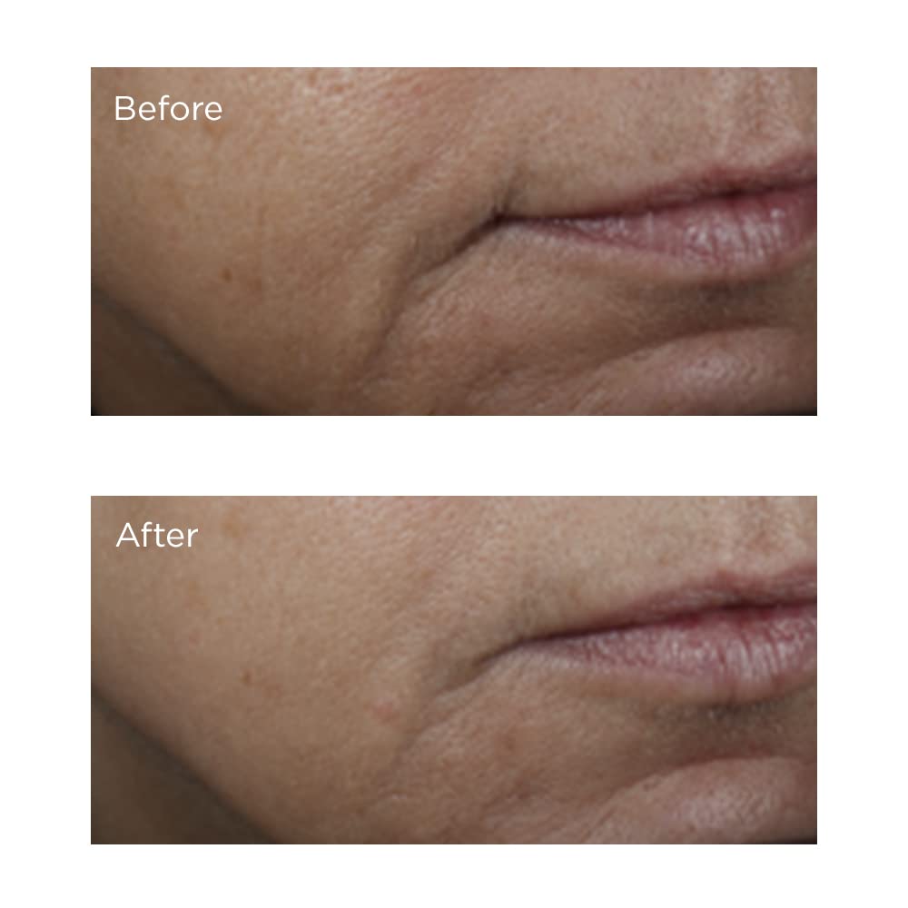 Perricone MD Vitamin C Ester Brightening Amine serum on face for smooth absorption.