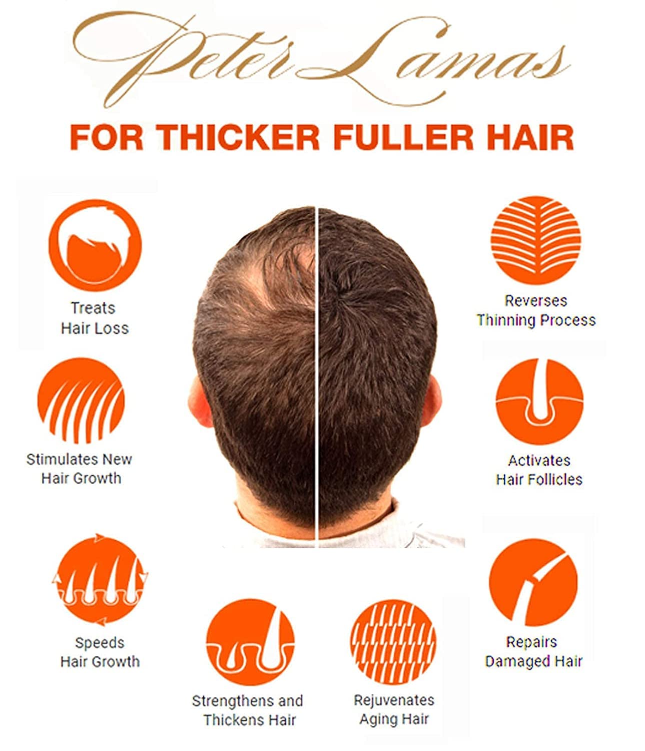 Peter Lamas DHT Blocker Shampoo label close-up highlights ingredients.