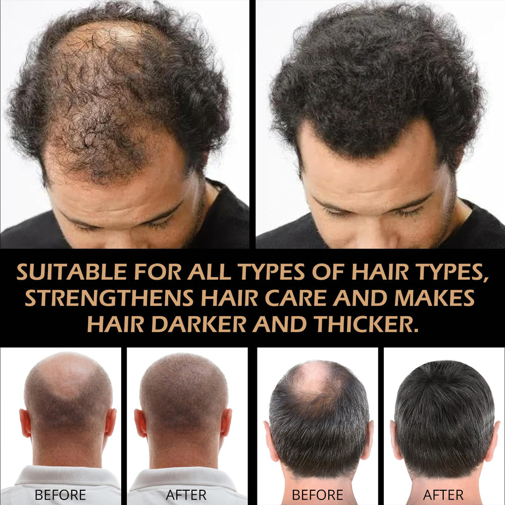 pewatul Root Activator Shampoo natural DHT blockers supporting follicle strength