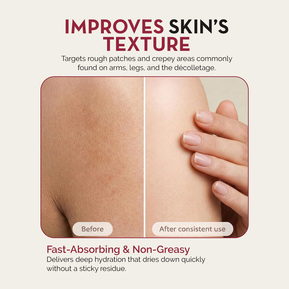 Applying Rosen Apothecary lotion helps smooth crepey areas.