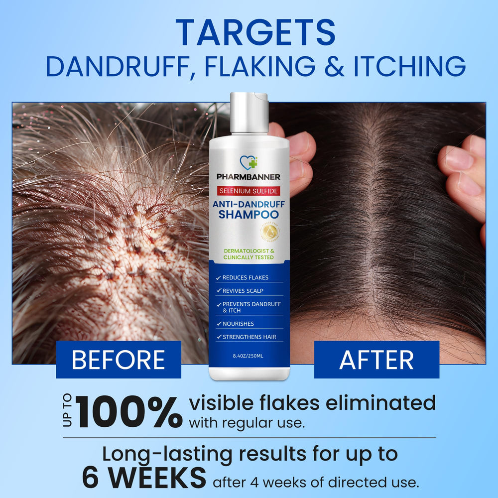 PHARMBANNER selenium sulfide formula highlights medicated scalp care