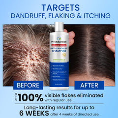 PHARMBANNER selenium sulfide formula highlights medicated scalp care