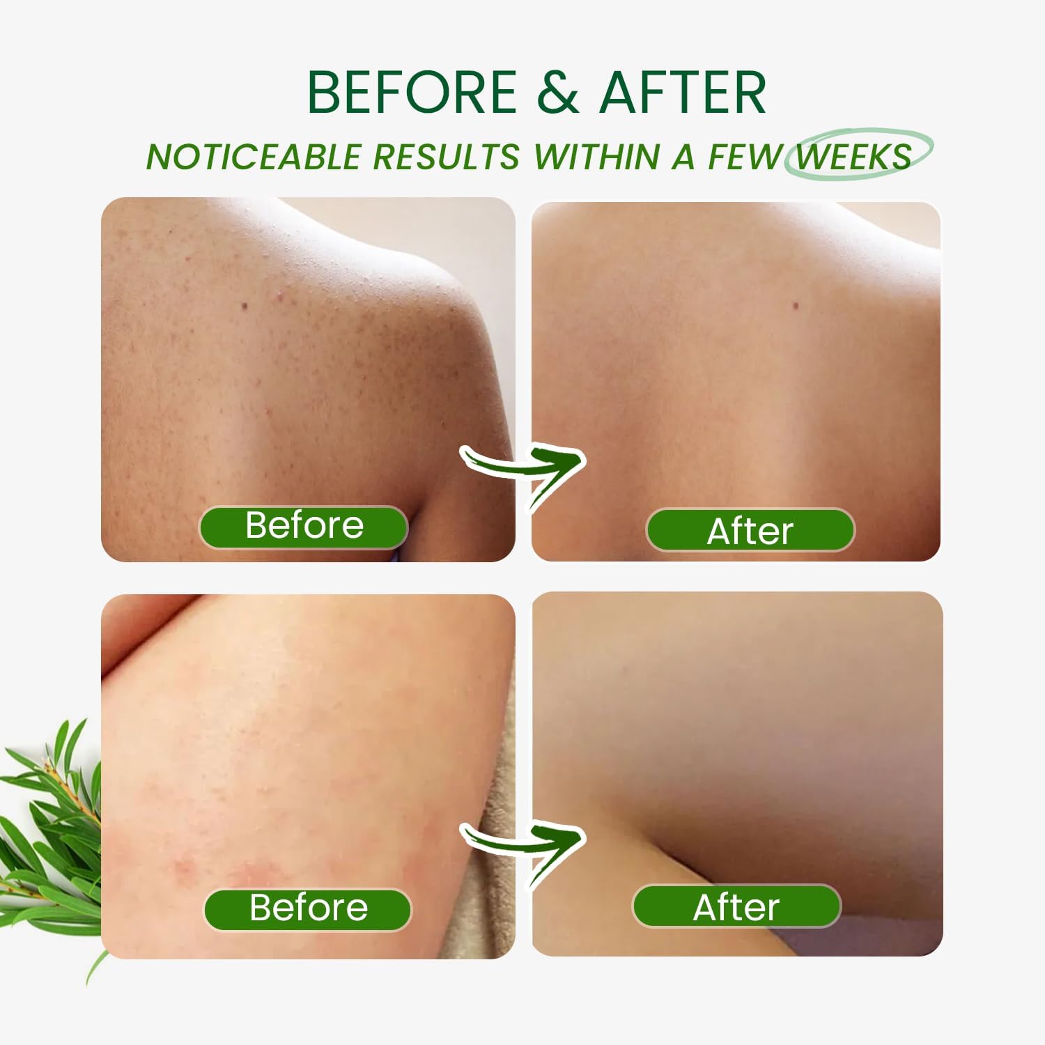 PHARMBANNER Tea Tree Body Wash body application demonstrates head-to-toe cleansing versatility.