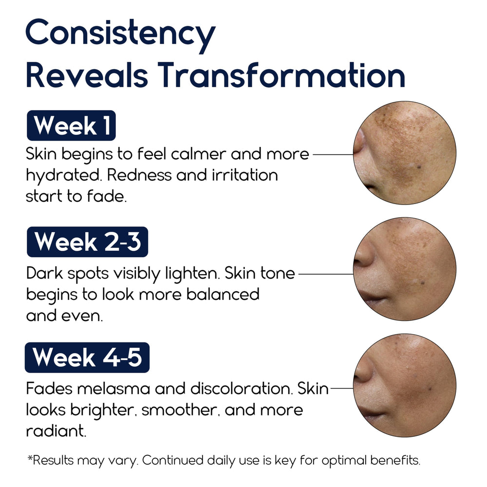 Pharmlitalia Dark Spot Remover close-up shows reduction of sun and age spots.