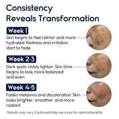 Pharmlitalia Dark Spot Remover close-up shows reduction of sun and age spots.