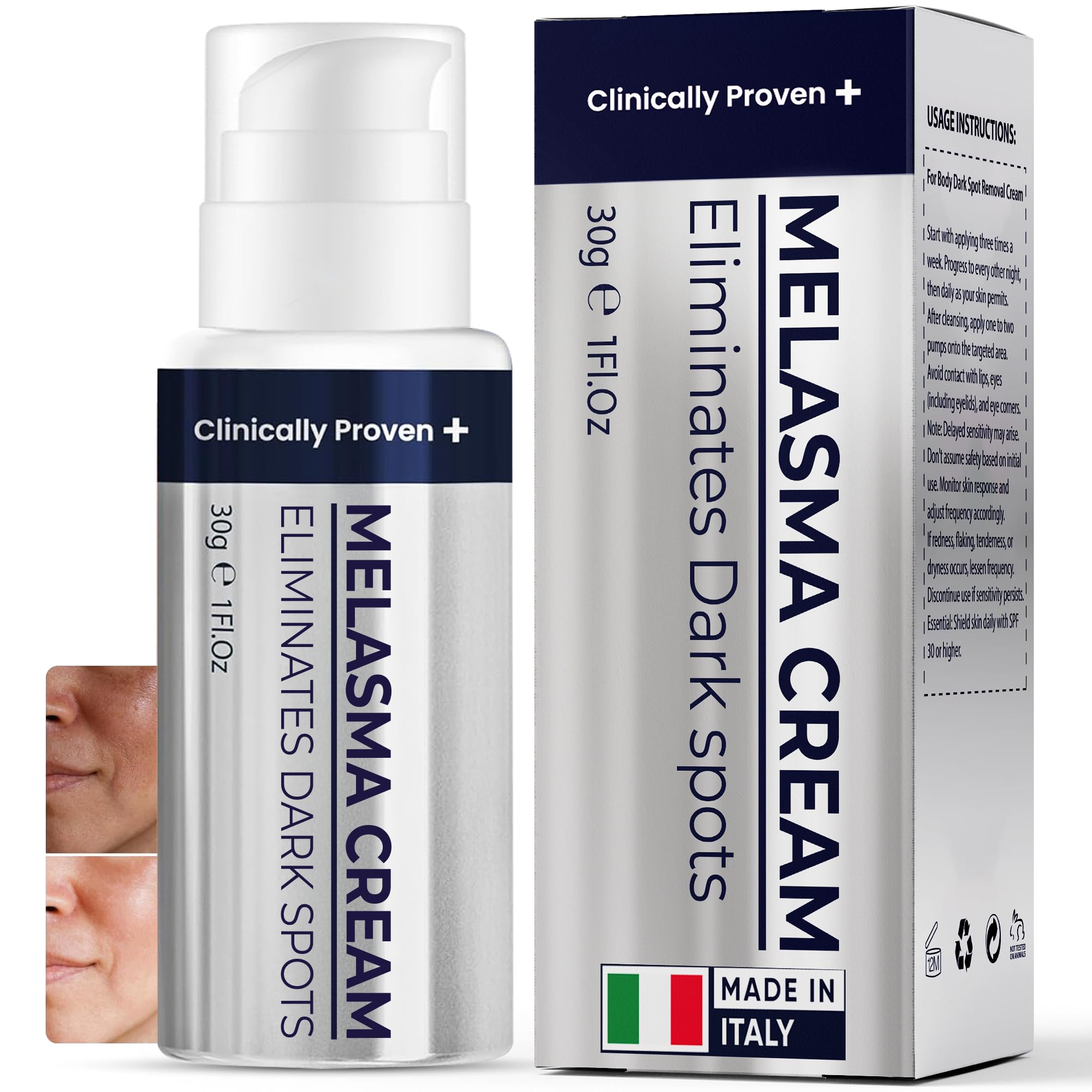 Pharmlitalia Melasma Cream on face for smoother, more even skin tone.