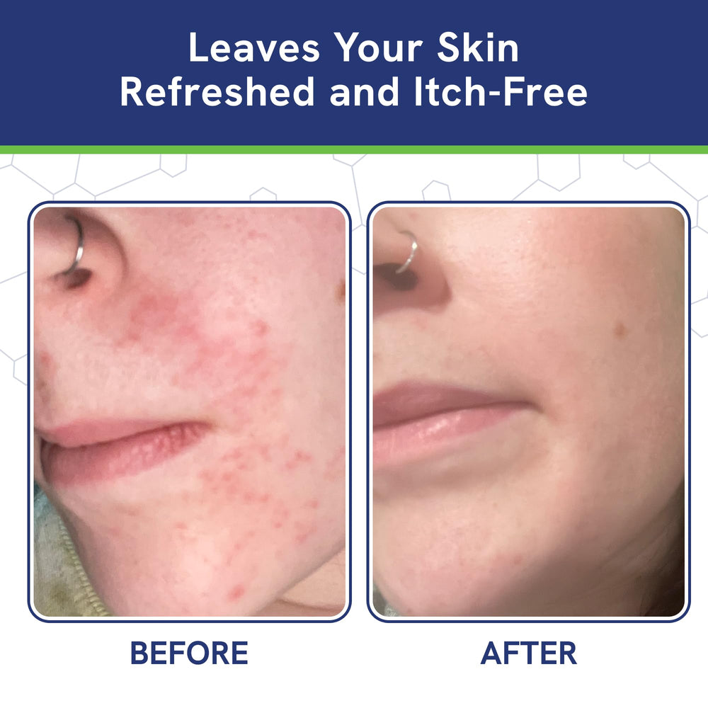 Vitamins A & C on the label indicate skin nourishment benefits.