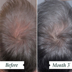 Philip Kingsley Density Preserving Serum dropper for targeted scalp application supporting density.