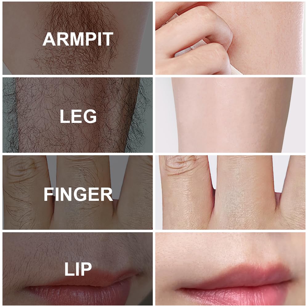 PHOFAY after-use skin appears calm and hydrated.