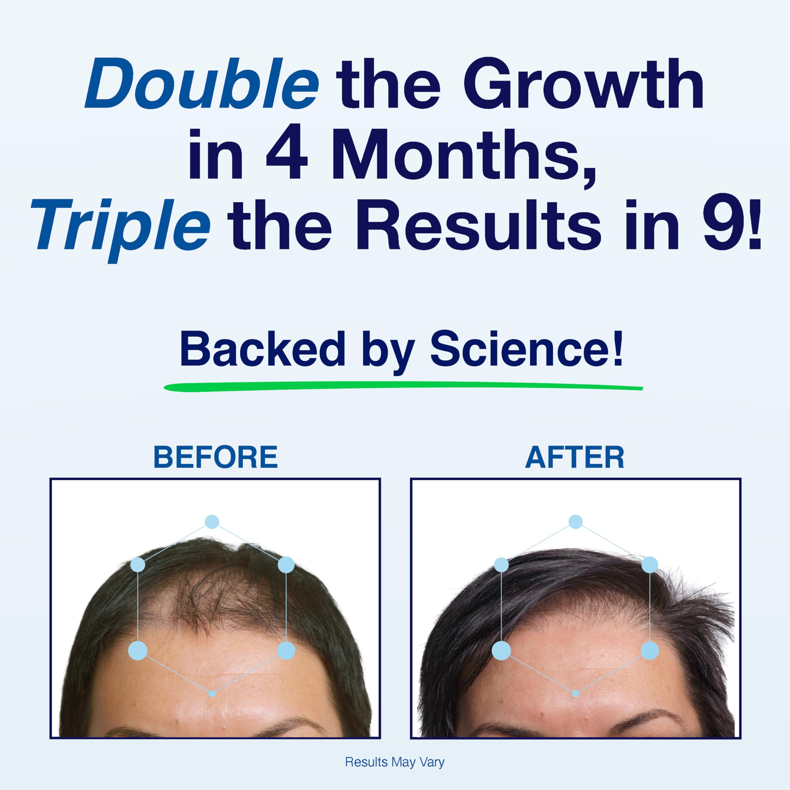 Phyllotex doctor-recommended badge on packaging signals trusted, doctor-endorsed hair care.