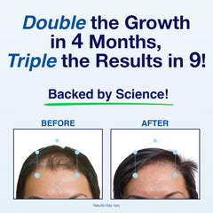 Phyllotex doctor-recommended badge on packaging signals trusted, doctor-endorsed hair care.