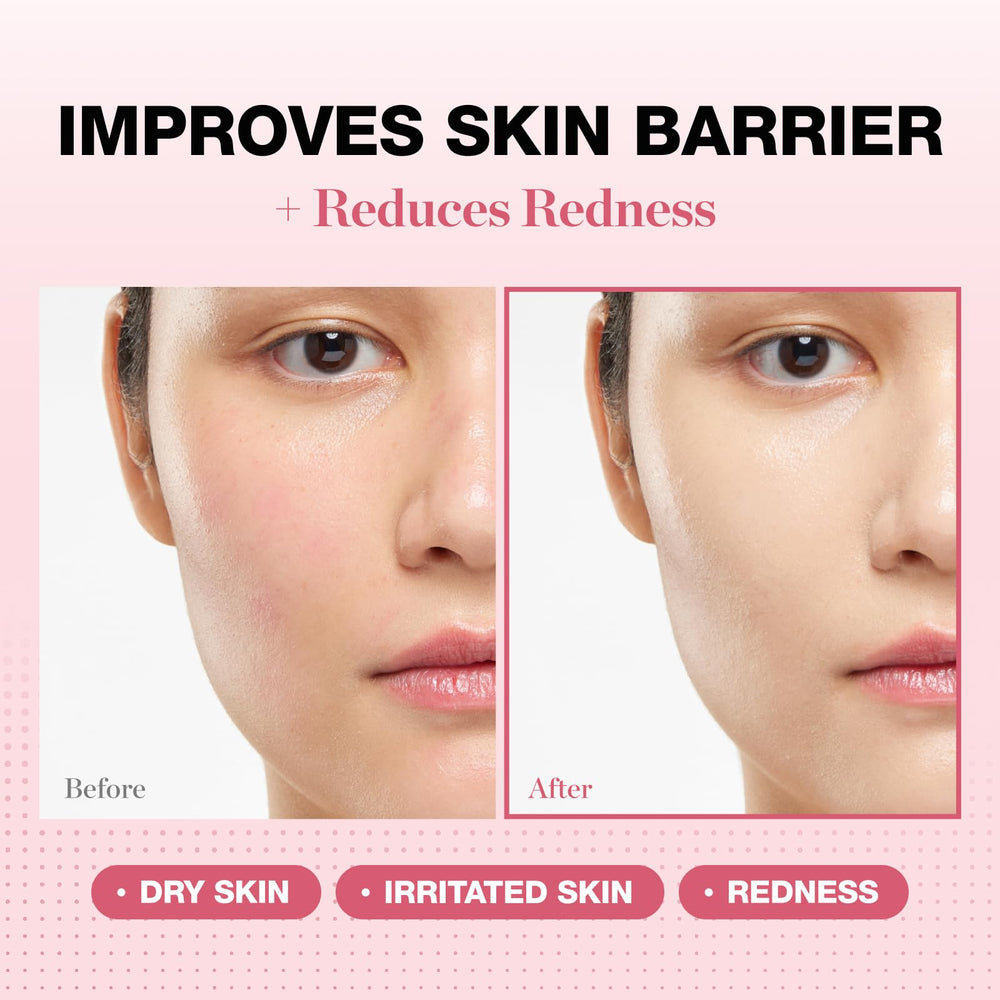 PHYSIOGEL ceramide moisturizer jar highlights barrier support for dry skin.