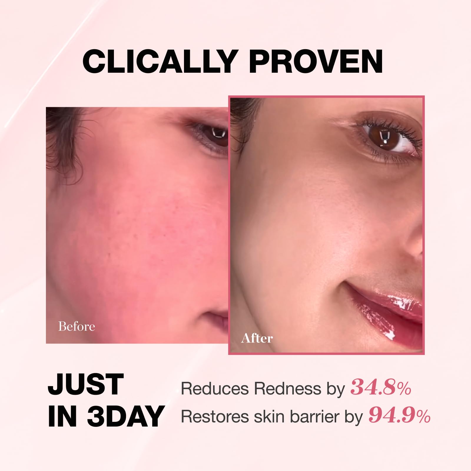 PHYSIOGEL cream texture close-up shows smooth formula.